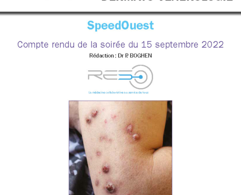 2022-11-speedouest