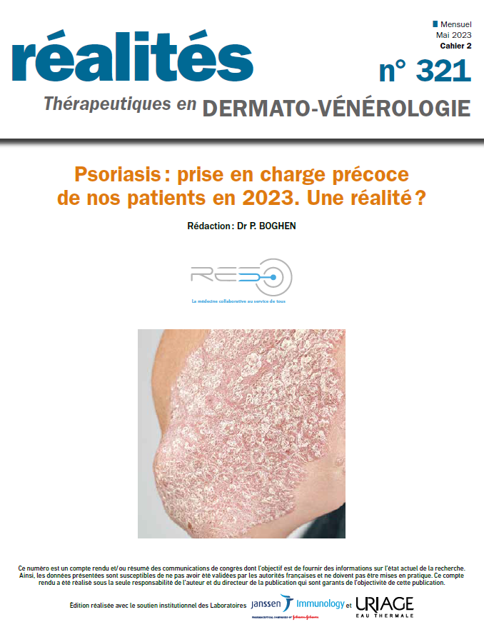 CR-PSORIASIS