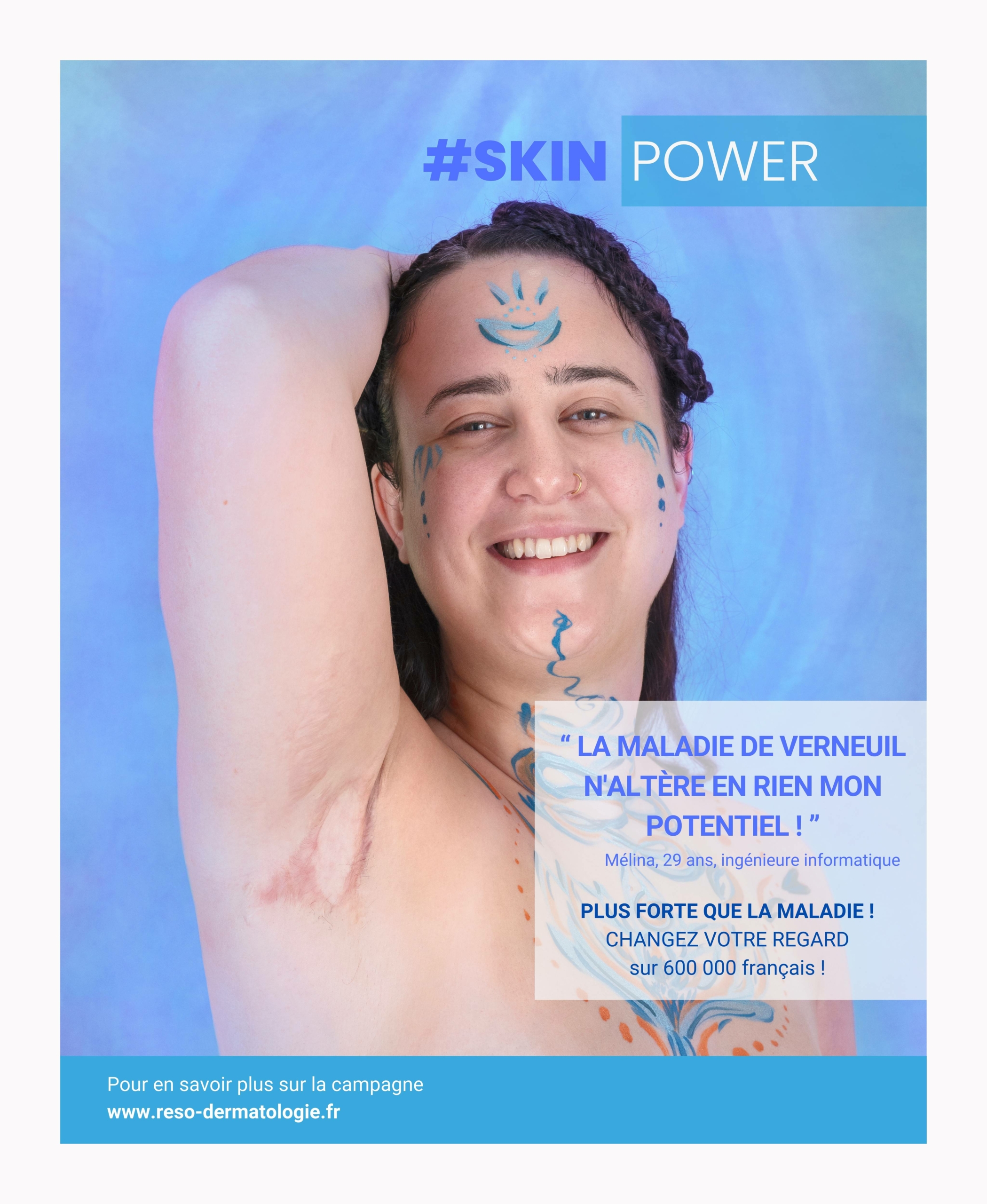 Skin Power_2