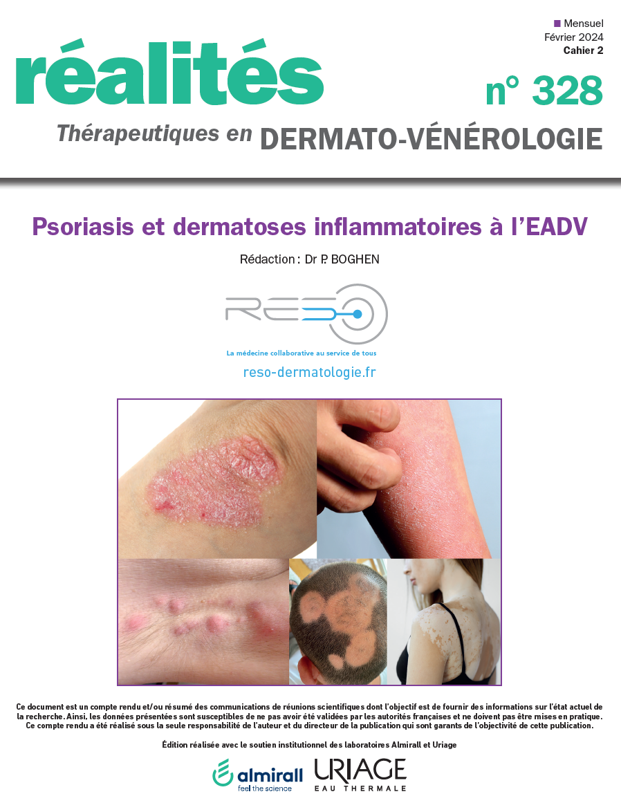 pso et dermatite atopique eadv