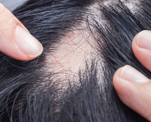 banniere-web-1920x900-pelade