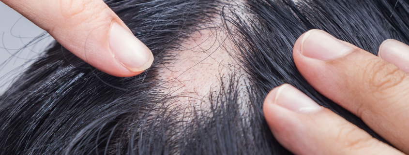 banniere-web-1920x900-pelade