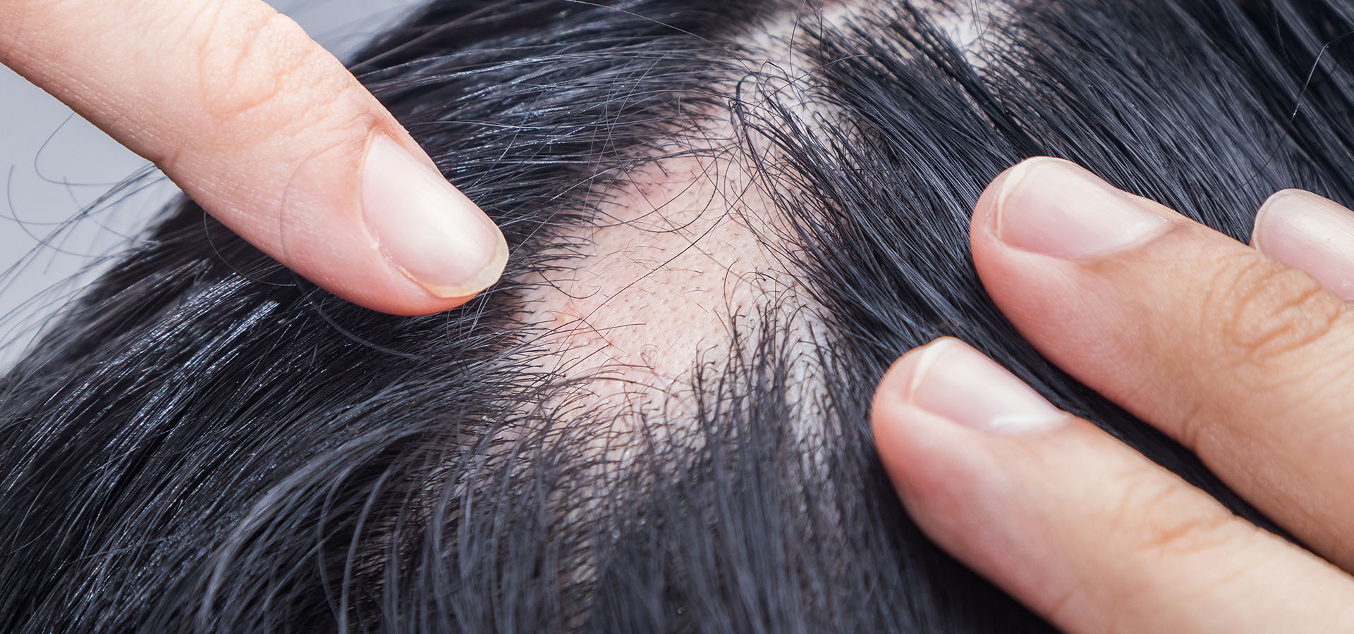 banniere-web-1920x900-pelade banniere-web-1920x900-pelade