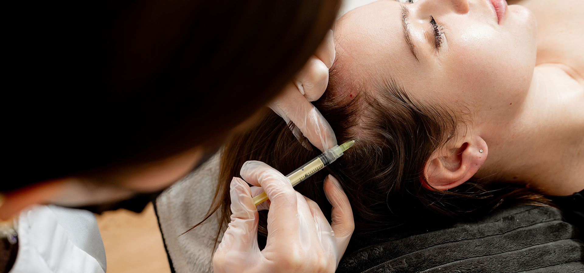 injection pelade injection pelade