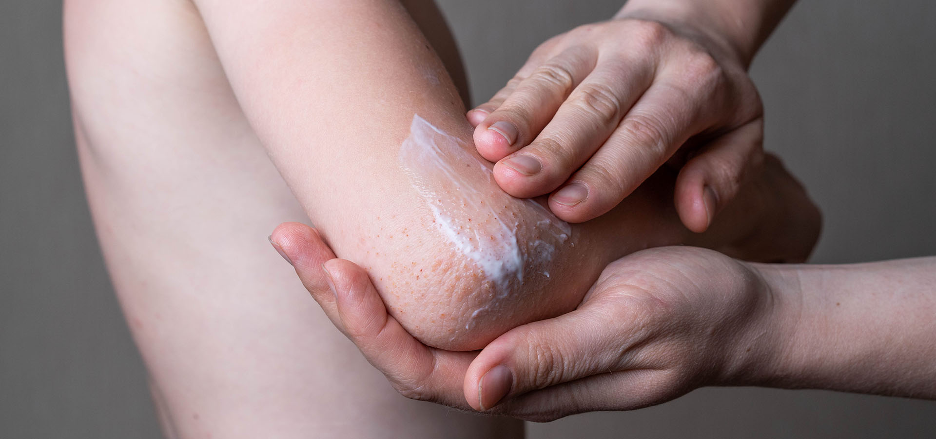 EMOLIENTS dermatite atopique enfant