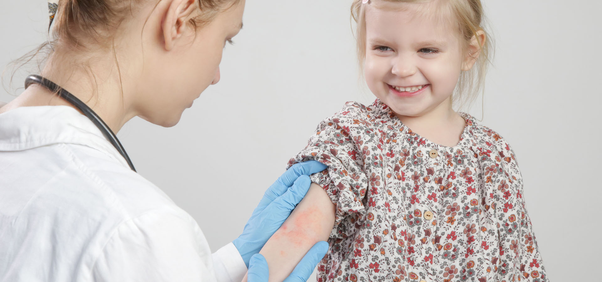 prise en charge dermatite atopique enfant