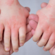 recommandation pediatriques aad