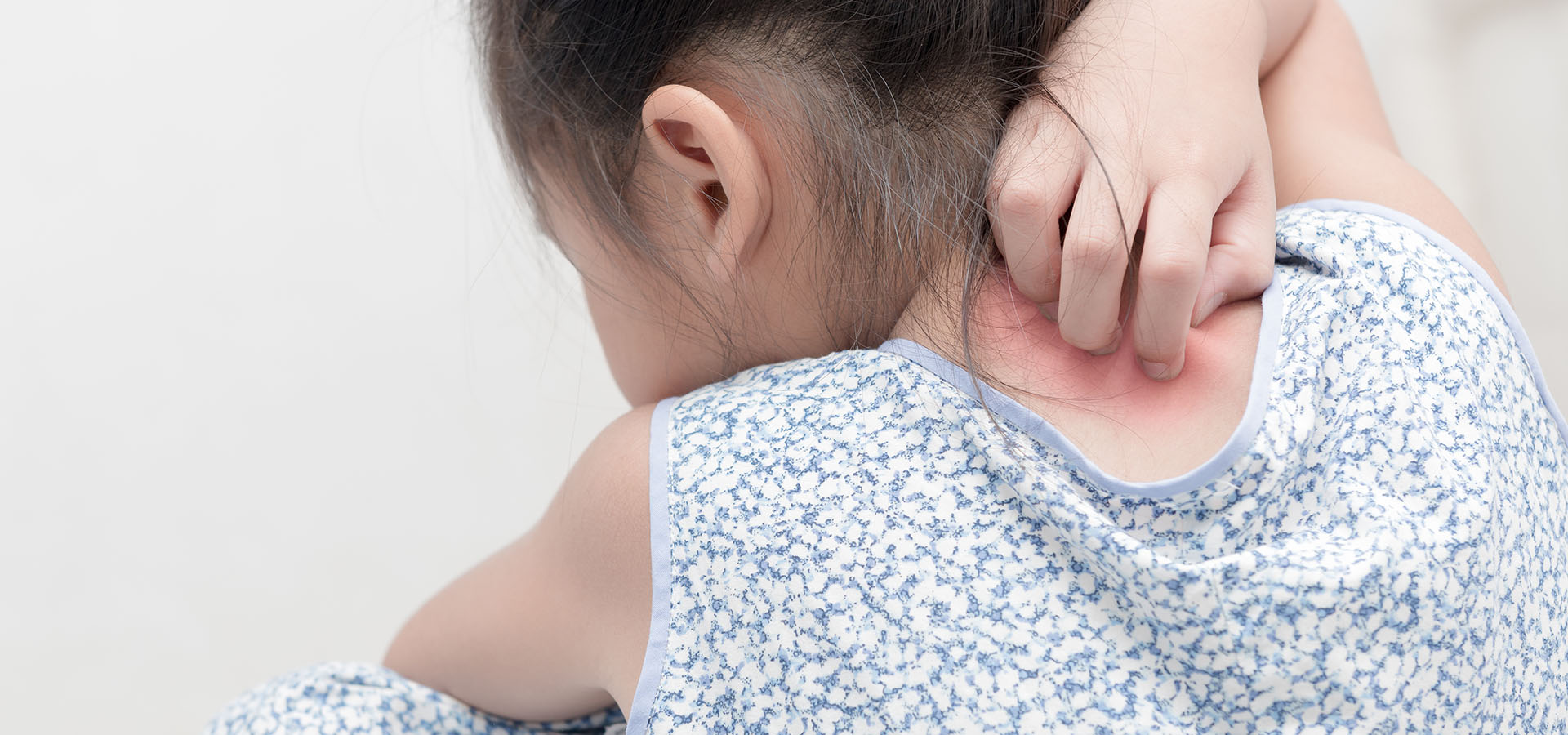 vie dermatite atopique enfant vie dermatite atopique enfant